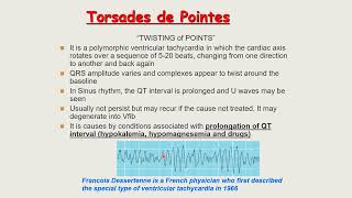 ecg lecture four part five wide complex tachycardia [upl. by Allerus638]