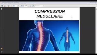 COMPRESSION MÉDULLAIRE [upl. by Ax]