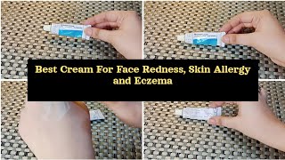 Advantan creamAdvantan cream uses for acne and pimples removalBest sun protection [upl. by Matejka]