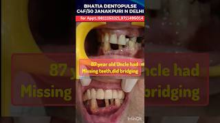 87year old uncle had missing teethdid bridgingstarted for lwr smilemakeover smiletransformation [upl. by Attoynek]