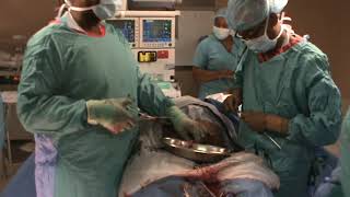 Caesarean Section procedure by Urogynaecologist Dr D T Mahapa  Tel 015 295 7770 [upl. by Behlau661]