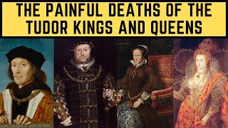 The PAINFUL Deaths Of The Tudor Kings and Queens  FULL Documentary [upl. by Adnauqaj]