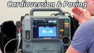 Lifepak 15 Part 3 Pacing and Cardioversion [upl. by Bobette]