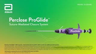 US Small Hole ProGlide™ Deployment Video [upl. by Desma]