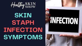 Symptoms Of A STAPH INFECTION On Your Skin  Jennifer Fugo [upl. by Lannie]