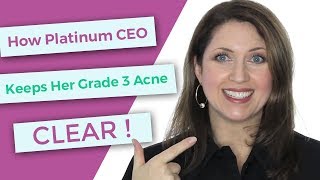 How Platinum Skin Care CEO Keeps Her Grade 3 Acne Skin Clear [upl. by Sande]