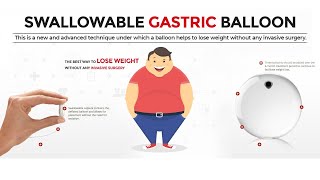 Swallowable Gastric Balloon Elipse Allurion Balloon Pill Side Effects Reviews Cost in India [upl. by Namolos264]