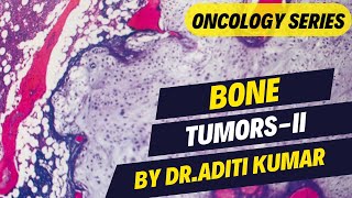 BONE TUMORS2 BY DRADITI KUMAR [upl. by Ennairek559]