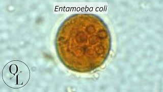 10 Entamoeba coli [upl. by Ahseuqal926]