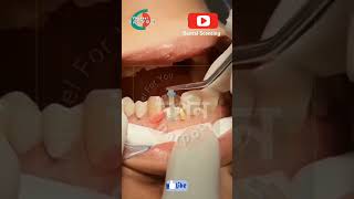 dentalscenting channel darpon livesamp naturr funny [upl. by Godewyn21]