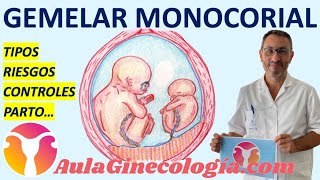 GEMELAR MONOCORIAL TIPOS RIESGOS CONTROLES PARTO COMPLICACIONES  Ginecología y Obstetricia [upl. by Narik966]