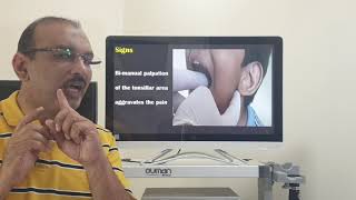 Stylohyoid syndrome Tamil Patient teaching programme [upl. by Shuma]