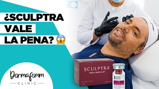 ¿REALMENTE EL SCULPTRA TE REJUVENECE  Descúbrelo Aquí [upl. by Auqkinahs]