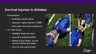 Concussion BurnersStingers amp Sports Cspine Injuries  ABOS Orthopedic Surgery Board Exam Review [upl. by Newcomer]