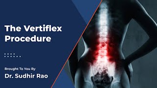 Vertiflex Treatment  Pain and Spine Specialists [upl. by Debarath]