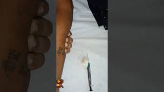 subcutaneous injection video skin test video vlog xylocaine sensitivity kaise kare full procedure [upl. by Delphine]