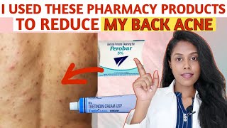 How did I cleared my BACK ACNE using only PHARMACY PRODUCTS தமிழில் [upl. by Purpura]