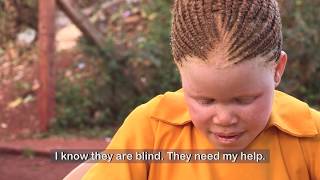 See my life experiences of people with Albinism in Africa [upl. by Ferdinand197]