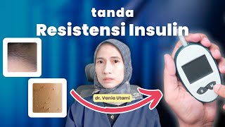 Tanda Resistensi Insulin amp Penanganannya  dr Vania Utami [upl. by Brinson]