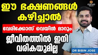 ഈ ഭക്ഷണങ്ങൾ കഴിച്ചു വെരികോസ് വെയ്ൻ പൂർണമായി മാറ്റം Vericose Treatment in Malayalam Dr Bibin Jose [upl. by Berner]