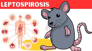 Leptospirosis  Causes Risk Factors Pathology Signs amp Symptoms Diagnosis And Treatment [upl. by Elianora]