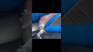 Charming Pedicure Video  Remove Dead Skin [upl. by Lovel802]