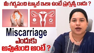 IVF Process  మీ గర్భసంచి ట్యూబ్ ఇలా ఉంటే ప్రెగ్నన్సీ రాదు  Miscarriage Symptoms  Way2Health [upl. by Yllor]