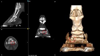 Fractured Navicular Bone [upl. by Elihu]