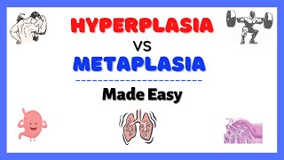 Hyperplasia and Metaplasia Dysplasia vs Neoplasia Cellular Adaptation Pathology Made Easy [upl. by Amsden]