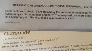 Octreotide And Carcinoid Cancer [upl. by Anairad]