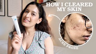 My 3 Step EvidenceBased Skincare Routine As A Doctor  HOW I CLEARED MY ACNE  Affordable Easy [upl. by Guimar]