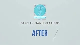 BEFORE amp AFTER FASCIAL MANIPULATION 2 [upl. by Johnson818]