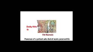 Cell Injury Pathology  Reversible and Irreversible Cell Injury  Part 2 doctor mbbs anatomy [upl. by Lucretia]