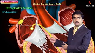 Cardiac output Quick review  CVS Physiology USMLE Step 1 [upl. by Lorinda894]