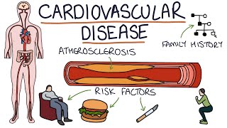 Understanding Cardiovascular Disease Visual Explanation for Students [upl. by Bradstreet]