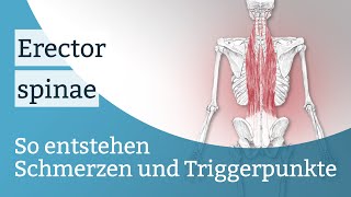 Erector spinae Schmerzen Triggerpunkte und deren Aktivierung [upl. by Llewsor]