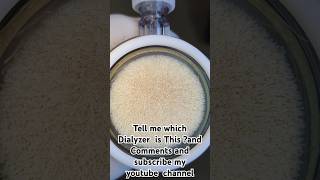 A dialyzer is a medical device used in hemodialysis to filter waste excess fluids and toxins [upl. by Idna831]