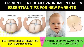 PREVENT FLAT HEAD SYNDROME IN BABIES ESSENTIAL TIPS FOR PARENTS  HOW TO AVOID FLAT HEAD IN BABIES [upl. by Mclain]