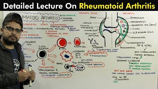 Rheumatoid Arthritis Pathophysiology of Arthritis [upl. by Sabelle]