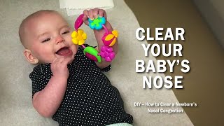 How to Clear Nasal Congestion in Newborns [upl. by Anial311]