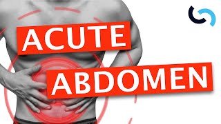 Acute Abdomen  Diagnosis and Management [upl. by Doersten835]