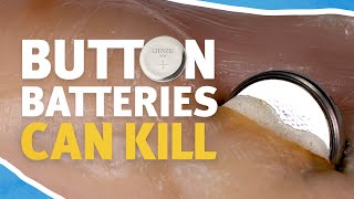 What happens when a button battery is ingested A chicken fillet and button battery 🐔 [upl. by Proctor808]