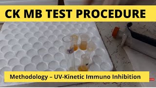 CK MB Procedure  Test for estimation of CKMB activity in serum [upl. by Cissej]