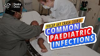 Crash Course Common Paediatric Infections  The MRCGP AKT Exam Revision I Dorky Docs [upl. by Revart]