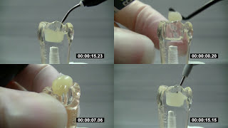 ESTELITE BULK FILL FLOW in comparison  Tokuyama Dental [upl. by Millar]