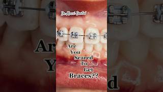 BRACES NO SCARES Orthodontics viral fashion shorts viral youtubeshorts braces dentist oralst [upl. by Amend]