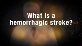 Medical Moment Hemorrhagic Stroke [upl. by Acinoev325]