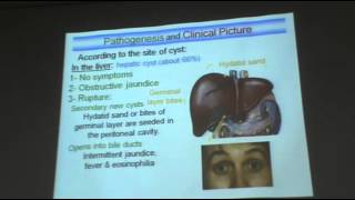 DrAzza   Parasitology quotEchinococcus granulosus amp hydatidosisquot [upl. by Adriano]