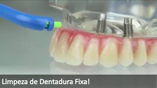 Limpeza de Dentadura Fixa [upl. by Ronyar]