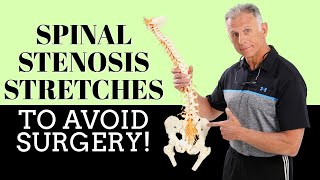 Best 3 Stretches To Quickly Remedy Lumbar Spinal Stenosis amp Avoid Surgery [upl. by Nisen]